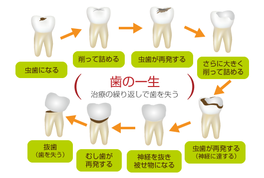 図解：歯の一生